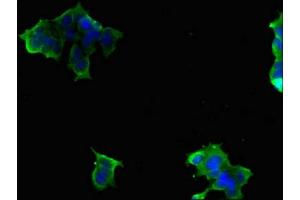 Immunofluorescence (IF) image for anti-Solute Carrier Family 9 (Sodium/hydrogen Exchanger), Member 6 (SLC9A6) (AA 510-669) antibody (ABIN7170027)