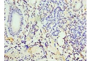 Immunohistochemistry of paraffin-embedded human pancreatic tissue using ABIN7156601 at dilution of 1:100 (IFNGR1 抗体  (AA 270-489))