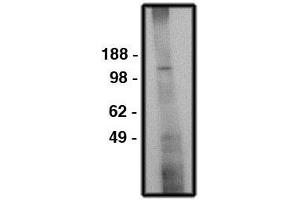 Image no. 1 for anti-Solute Carrier Family 9 (Sodium/hydrogen Exchanger), Member 6 (SLC9A6) antibody (ABIN793709) (SLC9A6 抗体)