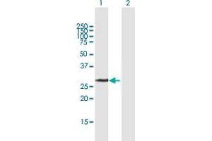 Western Blot analysis of UCK2 expression in transfected 293T cell line by UCK2 MaxPab polyclonal antibody.