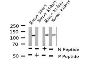 Western blot analysis of Phospho-NFAT4 (Ser165) expression in various lysates (NFATC3 抗体  (pSer165))