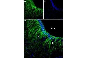 Expression of α2A-Adrenoreceptor in rat hypothalamus - Immunohistochemical staining of rat ventromedial hypothalamus free floating frozen section using Anti-α2A-Adrenergic Receptor (extracellular) Antibody (ABIN7042899, ABIN7043918 and ABIN7043919), (1:250). (ADRA2A 抗体  (Extracellular, N-Term))