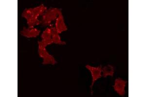 ABIN6266965 staining Hela by IF/ICC. (STON1 抗体  (C-Term))