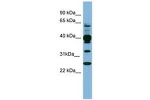 Image no. 1 for anti-Pleckstrin (PLEK) (N-Term) antibody (ABIN6741695) (Pleckstrin 抗体  (N-Term))