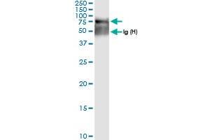 Immunoprecipitation of SGSH transfected lysate using anti-SGSH MaxPab rabbit polyclonal antibody and Protein A Magnetic Bead , and immunoblotted with SGSH MaxPab rabbit polyclonal antibody (D01) . (SGSH 抗体  (AA 1-502))