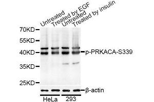 Western blot analysis of extracts of HeLa and 293 cells, using Phospho-PRKACA-S339 antibody (ABIN5995921) at 1/1000 dilution. (PRKACA 抗体  (pSer339))
