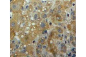 Used in DAB staining on fromalin fixed paraffin-embedded Liver tissue (ITGAL 抗体  (AA 809-1066))