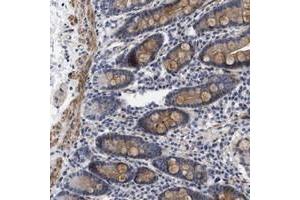 Immunohistochemical staining of human duodenum with SGEF polyclonal antibody  shows moderate cytoplasmic positivity in glandular cells as well as in the muscular layers. (SGEF 抗体)