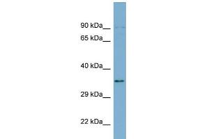 WB Suggested Anti-UBXN1 Antibody Titration: 0. (UBXN1 抗体  (Middle Region))