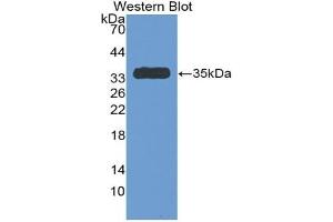 Detection of Recombinant Antithrombin, Rat using Polyclonal Antibody to Antithrombin (AT) (SERPINC1 抗体  (AA 150-426))