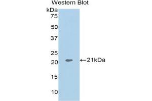 Western blot analysis of the recombinant protein. (ARPC4 抗体  (AA 3-163))