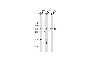 All lanes : Anti-RSPO1 Antibody (C-Term) at 1:2000 dilution Lane 1: HL-60 whole cell lysate Lane 2: Jurkat whole cell lysate Lane 3: K562 whole cell lysate Lysates/proteins at 20 μg per lane. (RSPO1 抗体  (AA 206-240))