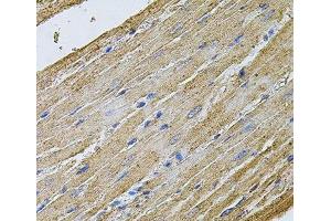 Immunohistochemistry of paraffin-embedded Rat heart using CDH16 Polyclonal Antibody at dilution of 1:100 (40x lens). (Cadherin-16 抗体)