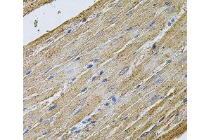 Immunohistochemistry of paraffin-embedded Rat heart using CDH16 Polyclonal Antibody at dilution of 1:100 (40x lens).