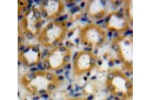 Used in DAB staining on fromalin fixed paraffin-embedded kidney tissue (TRAF6 抗体  (AA 254-475))