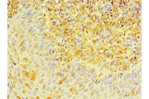 Immunohistochemistry of paraffin-embedded human tonsil tissue using ABIN7150706 at dilution of 1:100 (MAP2K3 抗体  (AA 1-170))