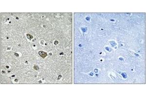 Immunohistochemistry (IHC) image for anti-Zinc Finger, DHHC-Type Containing 9 (ZDHHC9) (AA 315-364) antibody (ABIN1535143)