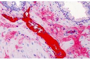 Anti-A2M / Alpha-2-Macroglobulin antibody IHC of human prostate. (alpha 2 Macroglobulin 抗体)
