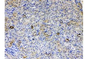 IHC analysis of ALDH1A3 using anti- ALDH1A3 antibody . (ALDH1A3 抗体  (AA 37-154))