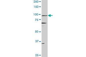 PGR monoclonal antibody (M08), clone 4E9. (Progesterone Receptor 抗体  (AA 1-110))