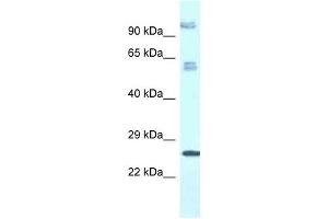 Western Blot showing TMEM222 antibody used at a concentration of 1. (TMEM222 抗体  (C-Term))