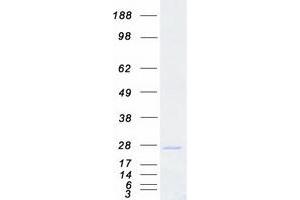 Western Blotting (WB) image for Synaptosomal-Associated Protein, 23kDa (SNAP23) (Transcript Variant 1) protein (Myc-DYKDDDDK Tag) (ABIN2732298)