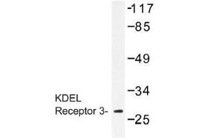 Image no. 1 for anti-KDEL (Lys-Asp-Glu-Leu) Endoplasmic Reticulum Protein Retention Receptor 3 (kDELR3) antibody (ABIN317836) (KDELR3 抗体)
