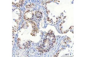 IHC analysis of DDX1 using anti-DDX1 antibody (ABIN7602052). (DDX1 抗体  (AA 562-740))