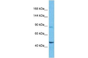 Host:  Rabbit  Target Name:  SUPT6H  Sample Type:  Lung Tumor lysates  Antibody Dilution:  1. (Spt6 抗体  (N-Term))