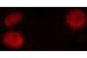 ABIN6274895 staining HeLa cells by IF/ICC. (Atrophin 1 抗体  (N-Term))