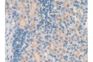 DAB staining on IHC-P; Samples: Rat Kidney Tissue (MT2 抗体  (AA 1-61))