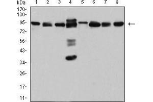 Western blot analysis using DDX1 mouse mAb against Hela (1), MCF-7 (2), A431 (3), PC-3 (4), NIH/3T3 (5), Jurkat (6), U251 (7), and HEK293 (8) cell lysate. (DDX1 抗体  (AA 642-740))