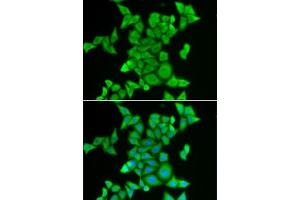 Immunofluorescence analysis of MCF7 cells using STRN3 antibody . (STRN3 抗体  (AA 200-460))