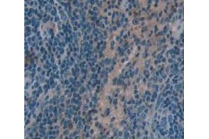 IHC-P analysis of Kidney tissue, with DAB staining. (HCK 抗体  (AA 2-524))