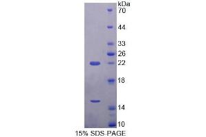 SDS-PAGE analysis of Mouse ECE2 Protein. (ECE2 蛋白)