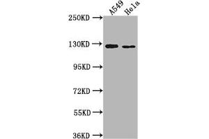 Western Blot Positive WB detected in: A549 whole cell lysate, Hela whole cell lysate All lanes: IGSF3 antibody at 1:2000 Secondary Goat polyclonal to rabbit IgG at 1/50000 dilution Predicted band size: 136, 138 kDa Observed band size: 125 kDa (IGSF3 抗体  (AA 111-399))