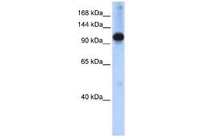 WB Suggested Anti-SMARCAL1 Antibody Titration:  0. (SMARCAL1 抗体  (N-Term))