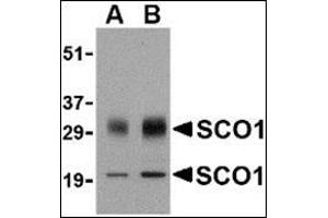 Western blot analysis of SCO1 in human brain tissue lysate with this product at (A) 0. (SCO1 抗体  (Center))