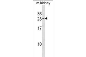 VPS25 Antibody (C-term) (ABIN1881995 and ABIN2838714) western blot analysis in kidney cell line lysates (35 μg/lane). (VPS25 抗体  (C-Term))