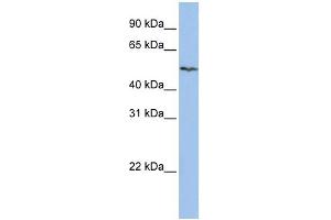 WB Suggested Anti-SLC16A6 Antibody Titration:  0. (SLC16A6 抗体  (Middle Region))