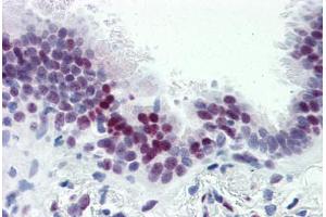 Human Lung (formalin-fixed, paraffin-embedded) stained with CASZ1 antibody ABIN364232 at 5 ug/ml followed by biotinylated goat anti-rabbit IgG secondary antibody ABIN481713, alkaline phosphatase-streptavidin and chromogen. (CASZ1 抗体  (N-Term))
