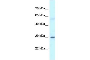 WB Suggested Anti-EIF6 Antibody Titration: 1. (EIF6 抗体  (C-Term))