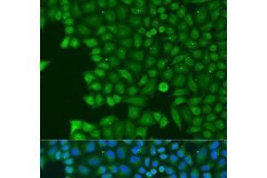 Immunofluorescence analysis of U2OS cells using ABCE1 Polyclonal Antibody at dilution of 1:100. (ABCE1 抗体)