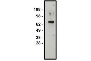 Image no. 1 for anti-Solute Carrier Family 9, Subfamily A (NHE1, Cation Proton Antiporter 1), Member 1 (SLC9A1) antibody (ABIN4620363) (SLC9A1 抗体)