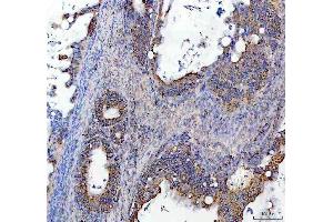 IHC analysis of SOCS5 using anti-SOCS5 antibody (ABIN7601562).