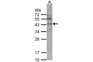 WB Image Sample (30 ug of whole cell lysate) A: 293T 12% SDS PAGE antibody diluted at 1:500 (CAMK1D 抗体)