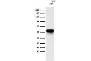 Western Blotting (WB) image for anti-Epithelial Cell Adhesion Molecule (EPCAM) antibody (ABIN6939993)