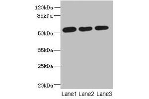 Western blot All lanes: ARMT1 antibody at 0. (ARMT1 (AA 2-250) 抗体)