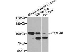 Western blot analysis of extracts of various cell lines, using PCDHA6 antibody. (PCDHA6 抗体)