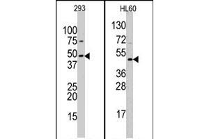 Western blot analysis of SUV39H2 polyclonal antibody  in 293 and HL-60 cell line lysates (35 ug/lane). (SUV39H2 抗体  (AA 308-337))